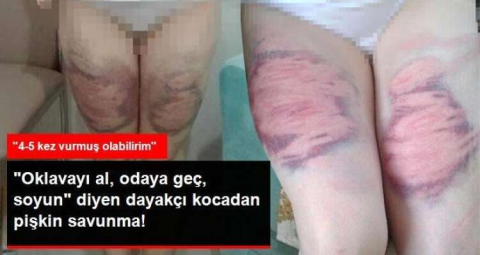 DAYAKÇI KOCADAN PİŞKİN SAVUNMA
